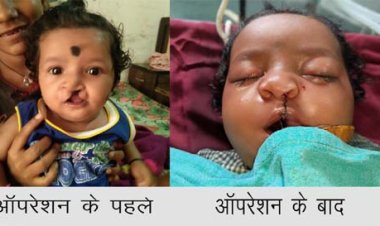 चिरायु योजना ने लौटाई मासूमों की मुस्कान
