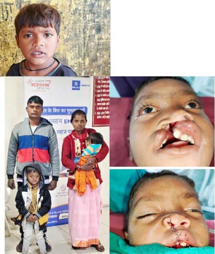 बस्तर के वनांचल से खिलखिलाती मुस्कान की नई इबारत लिख रहा नन्हा विक्रम