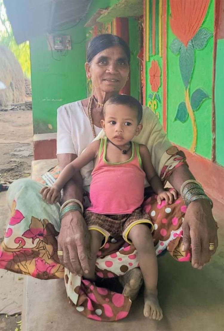 जन्म से बंद थे मलद्वार और मूत्र मार्ग, दो सफल ऑपरेशनों ने बदली अरुलेश की जिंदगी
